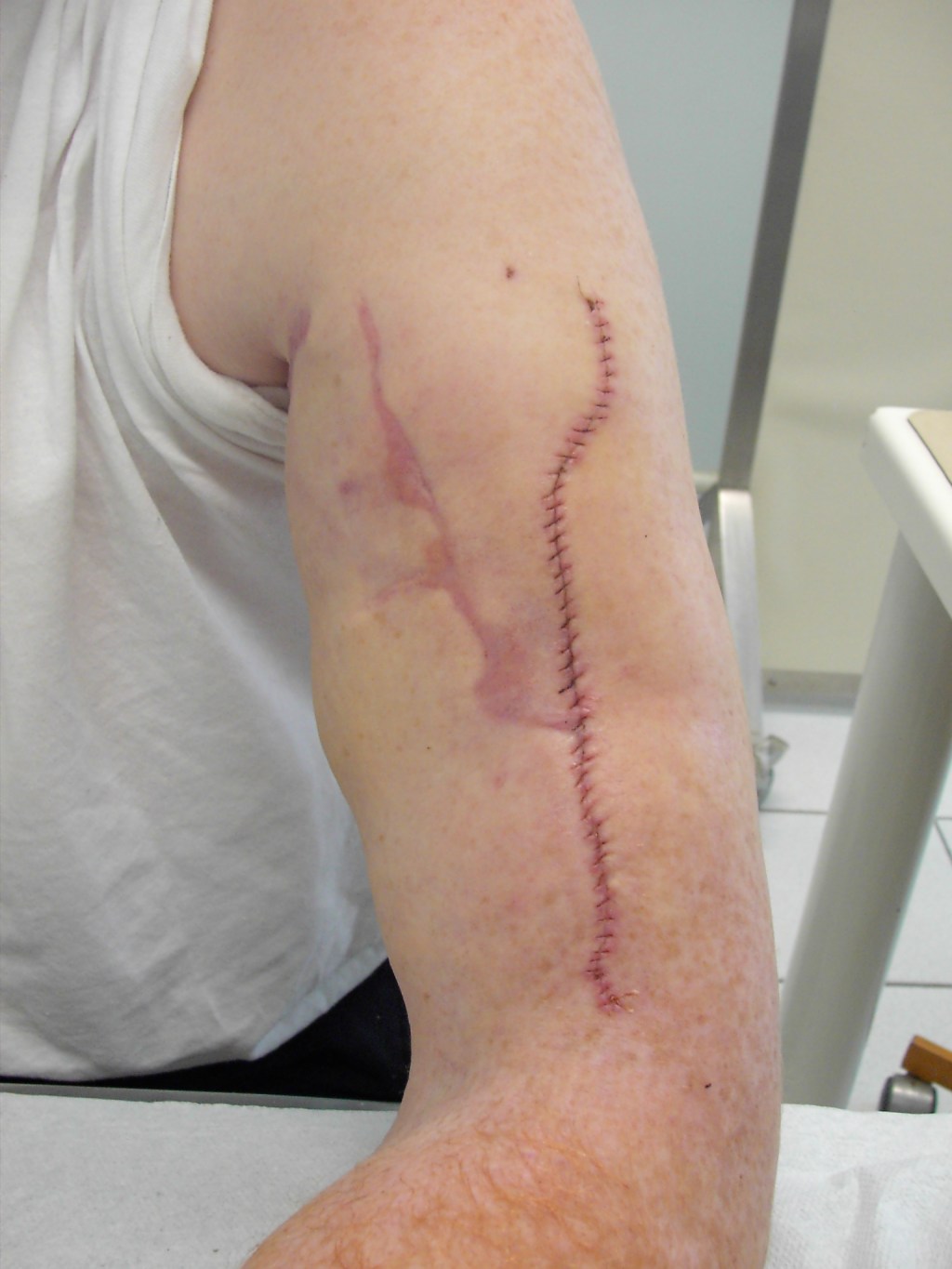 Le Fractal Cyclique.